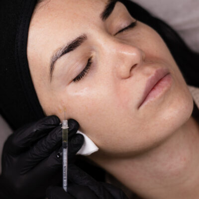 DRAKULOTERAPIA + EXOZÓMY